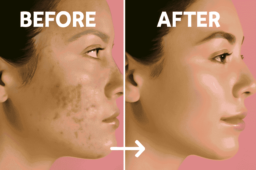 "नीम की पत्तियाँ और त्वचा के फायदे", "सुबह नीम चबाने का तरीका"